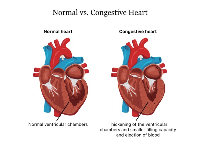 Artery explanations nbme cardiac subclavian